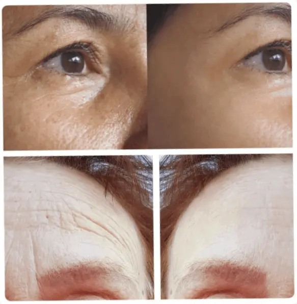 Ikaria Lean Belly Juice timeless beauty before after results
